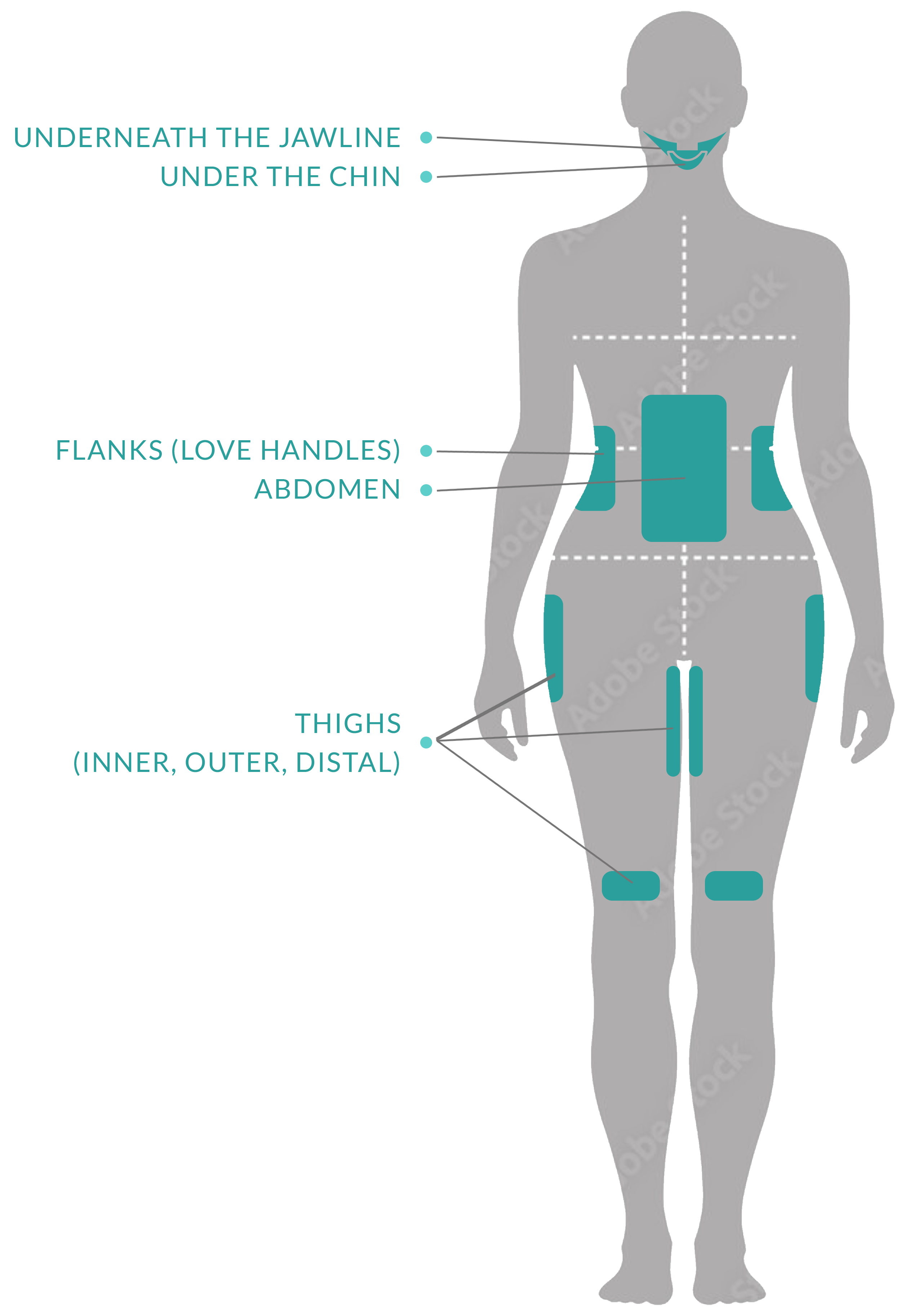 Diagram of female back showing body zones targeted by CoolSculpting: Under the Jawline, Under Chin, Flank (Love Handles), Abdomen, Inner Thighs, Outer Thighs, and Distal Thighs