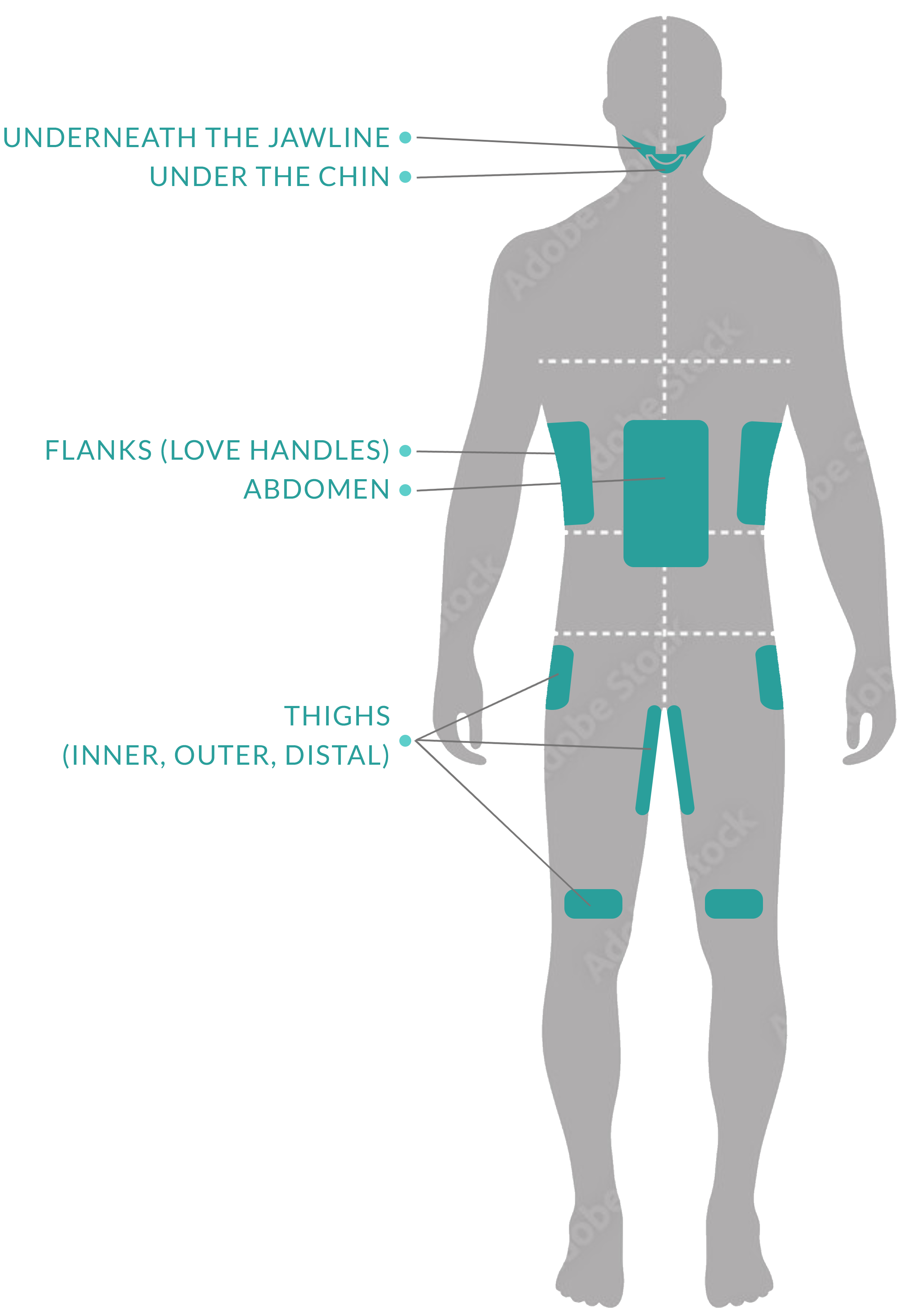 Diagram of male back showing body zones targeted by CoolSculpting: Under the Jawline, Under Chin, Flank (Love Handles), Abdomen, Inner Thighs, Outer Thighs, and Distal Thighs